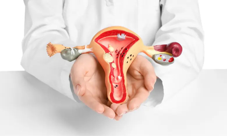 Polikistik Over Sendromu